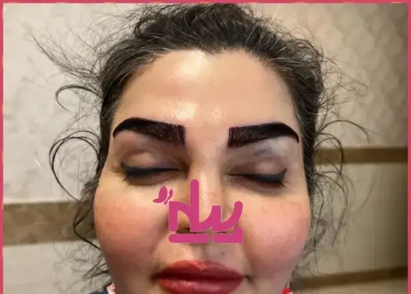 عکس ابرو کاشته شده