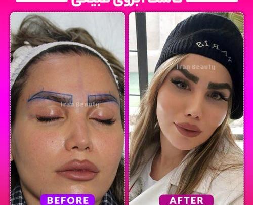 عکس ابرو کاشته شده
