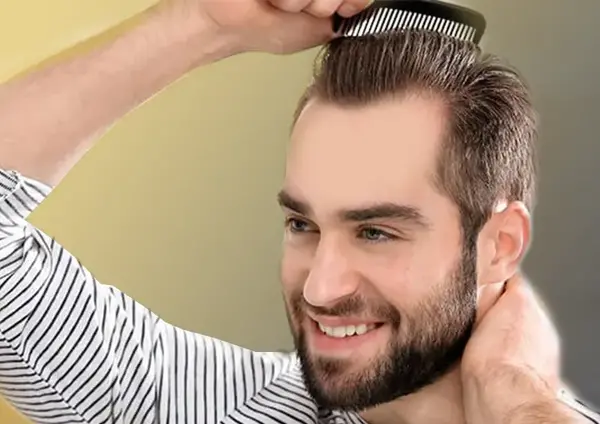 عکس های کاشت مو قبل و بعد