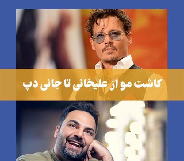 عکس قبل و بعد کاشت مو علی قلی زاده