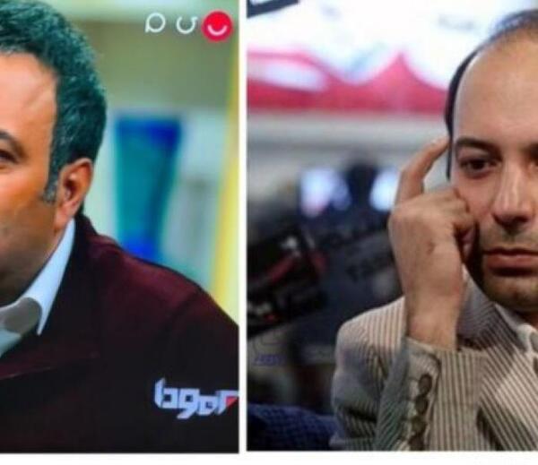عکس قبل و بعد کاشت مو علی قلی زاده