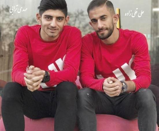 عکس قبل و بعد کاشت مو علی قلی زاده