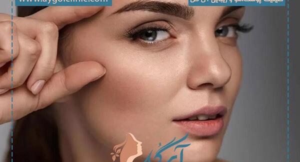 عکس های قبل و بعد کاشت ابرو