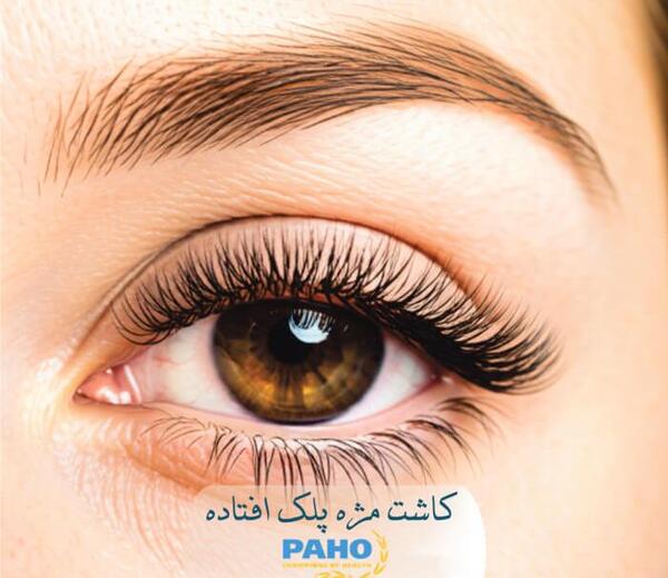 عکس کاشت طبیعی مژه