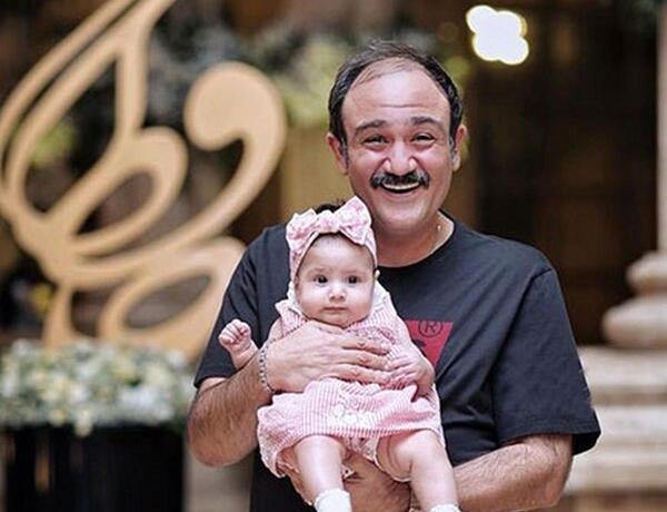 عکس مهران غفوریان بعد از کاشت مو