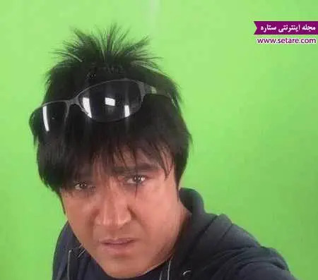 عکس مهران غفوریان بعد از کاشت مو