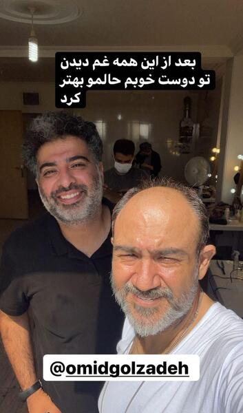 عکس مهران غفوریان بعد از کاشت مو