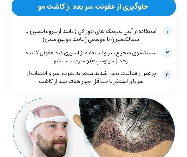 عکس عفونت سر بعد از کاشت مو