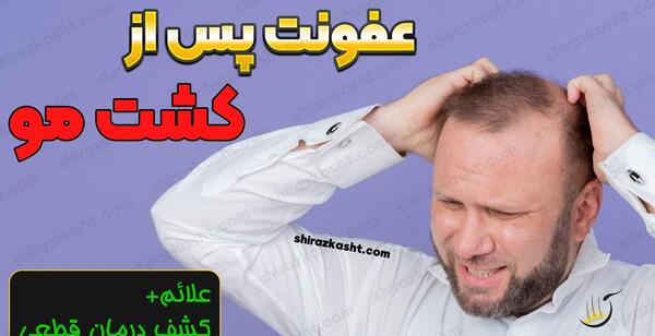 عکس عفونت سر بعد از کاشت مو