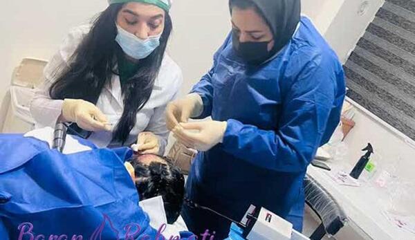 عکس اتاق عمل کاشت مو