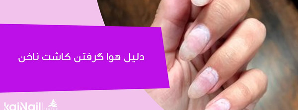 عکس قارچ ناخن کاشت شده