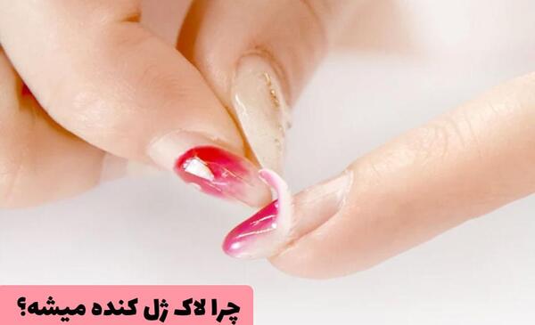 عکس کاشت ناخن خراب شده