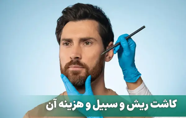 عکس های کاشت ریش