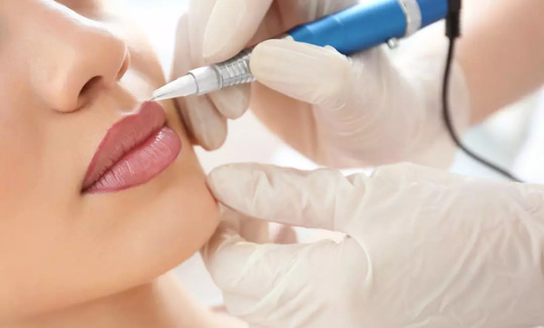 عکس کاشت رژلب دائم
