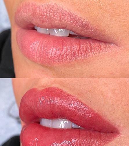 عکس کاشت رژلب دائم