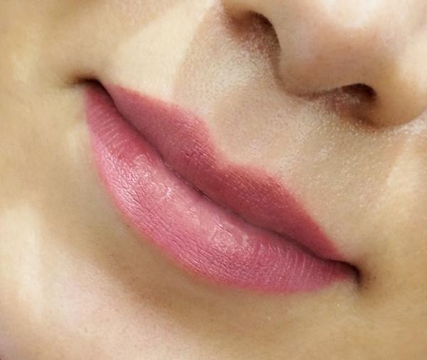 عکس کاشت رژلب دائم