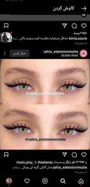 عکس کاشت مژه نی نی سایت