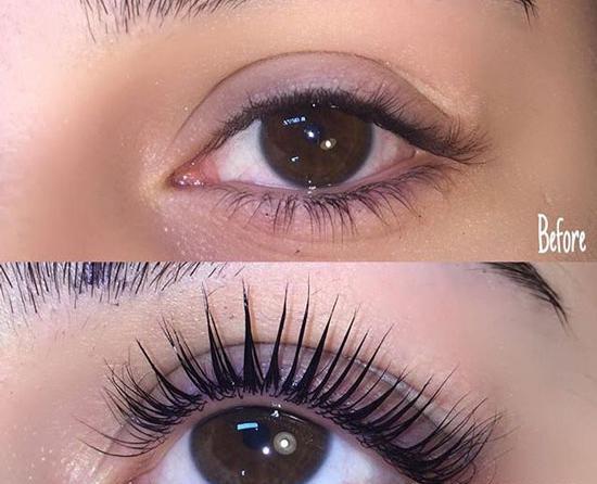 عکس کاشت مژه نی نی سایت