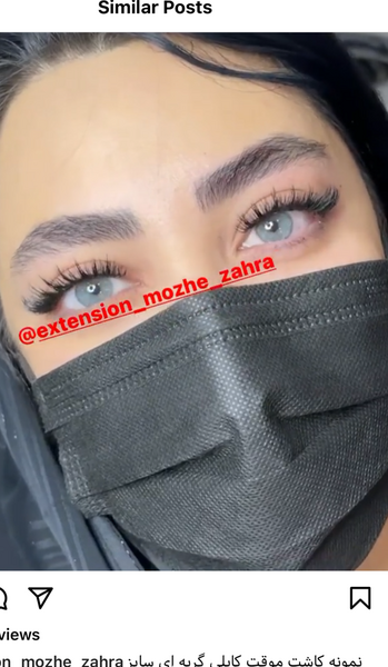 عکس کاشت مژه نی نی سایت