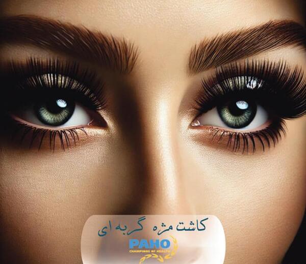 عکس کاشت مژه مدل گربه ای