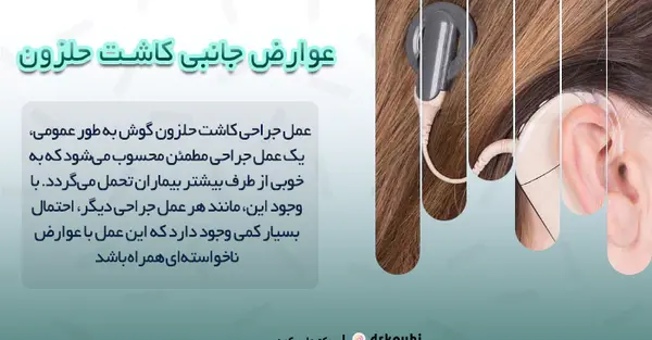 عکس دستگاه کاشت حلزون