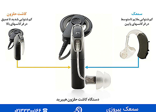 عکس سمعک کاشت حلزون