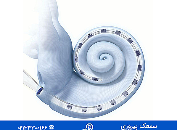 عکس سمعک کاشت حلزون