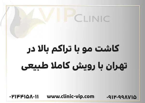 عکس کاشت مو با تراکم بالا