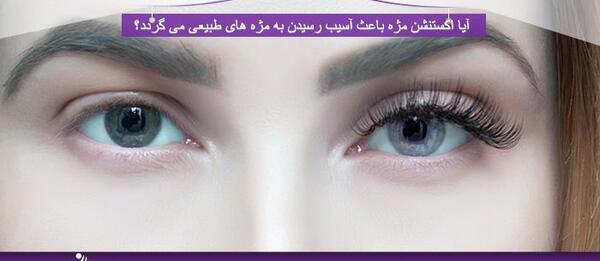 عکس قبل و بعد کاشت مژه طبیعی