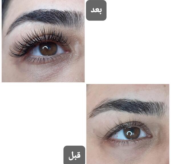 عکس قبل و بعد کاشت مژه طبیعی