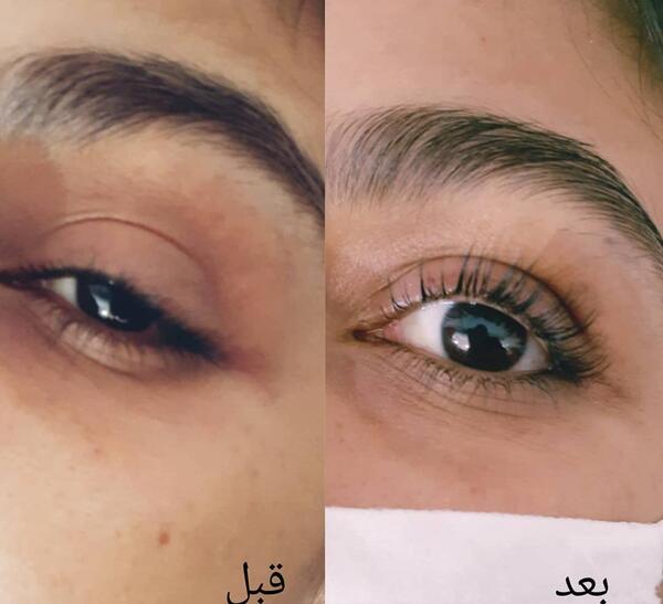 عکس قبل و بعد کاشت مژه طبیعی