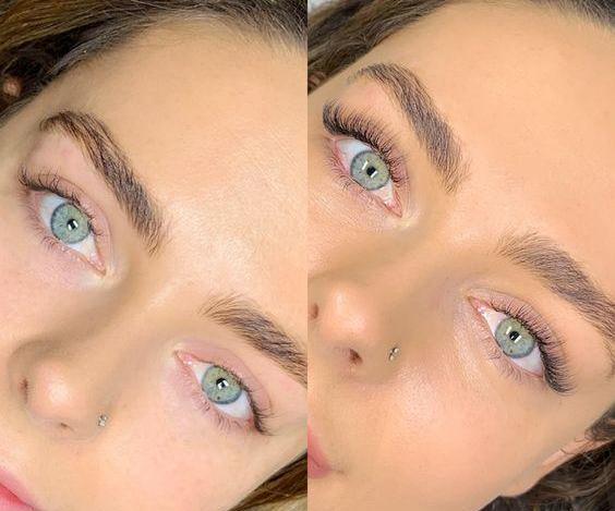 عکس قبل و بعد کاشت مژه طبیعی