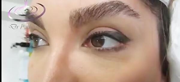 عکس از کاشت مژه طبیعی