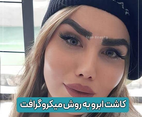 عکس کاشت ابرو بعد از یک ماه