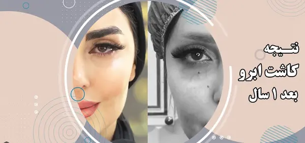 عکس کاشت ابرو بعد از یک ماه