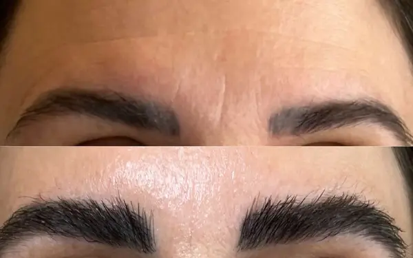 عکس کاشت ابرو بعد از یک ماه