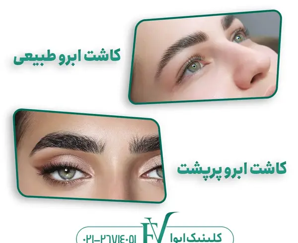 عکس مدل کاشت ابروی طبیعی