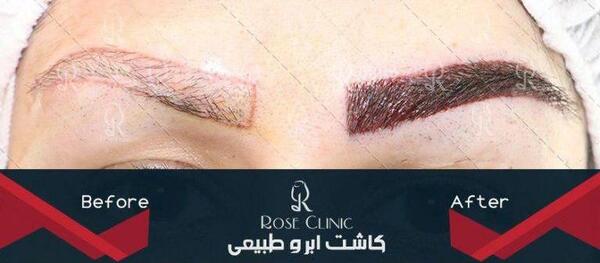 عکس مدل کاشت ابروی طبیعی