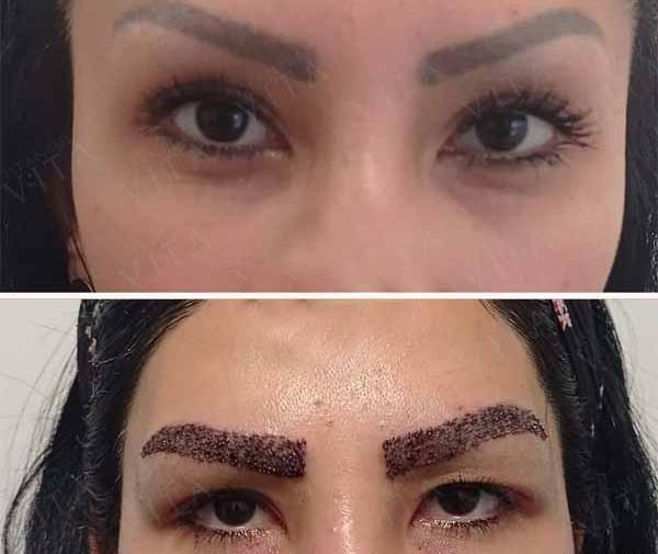 عکس مدل کاشت ابروی طبیعی