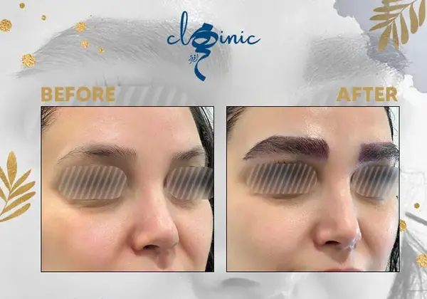 عکس مدل کاشت ابروی طبیعی