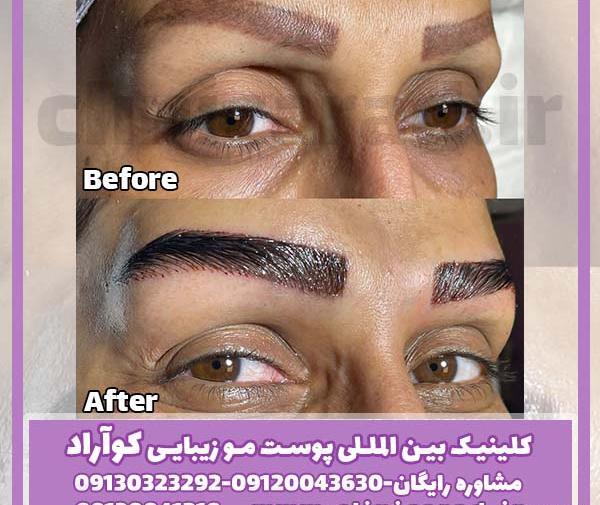 عکس مدل کاشت ابروی طبیعی