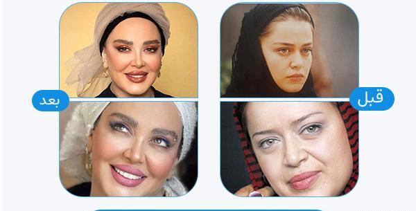 عکس کاشت ابرو بعد از دو ماه
