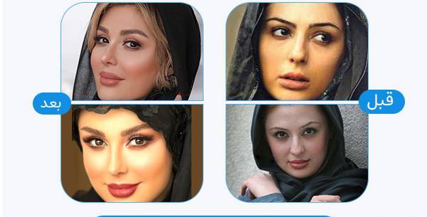 عکس کاشت ابرو بعد از دو ماه