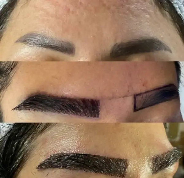 عکس کاشت ابرو بعد از دو ماه