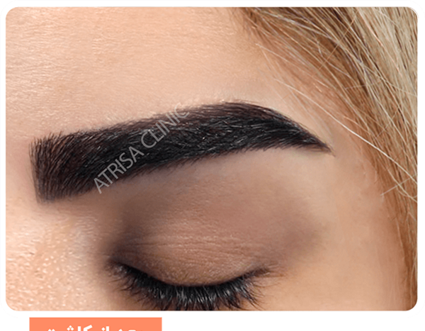 عکس کاشت ابرو دخترانه