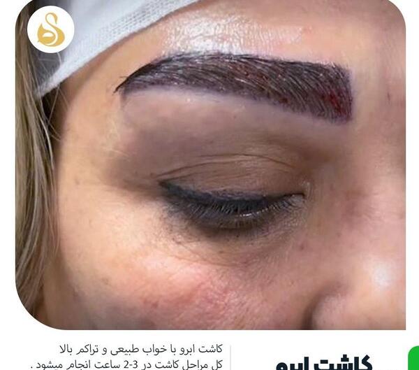 عکس کاشت ابرو دخترانه