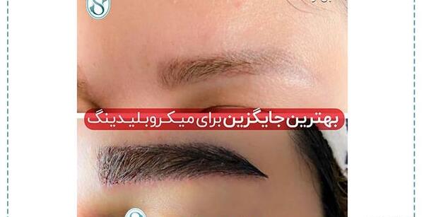 عکس کاشت ابرو دخترانه