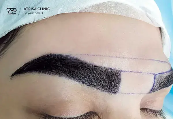 عکس کاشت ابرو دخترانه