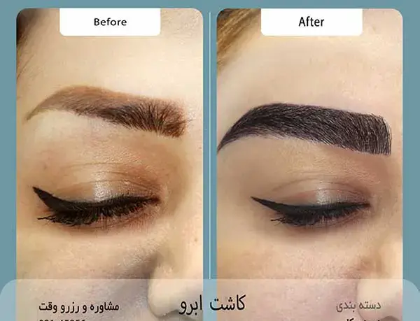 عکس کاشت ابرو با موی طبیعی