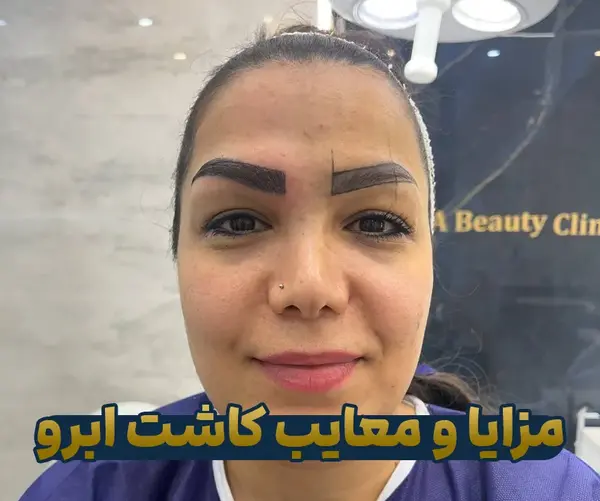 عکس کاشت ابرو با موی طبیعی